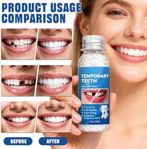 2 BottlesTooth Repair Kit,Moldable False Teeth Beads with A Set of Oral Care Tools,Dental Care Kit Fixing Broken Teeth,Temporary Tooth Filling for Teeth Repair,Help for Confident Smiles