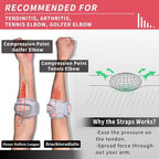 INDEEMAX Elbow Brace for Tendonitis and Tennis Elbow Strap for Women Men, 2 Pack Golfers Elbow Brace Counterforce Band with Compression Pad, Effective Tendon Pain Relief, Pink