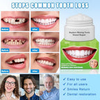 Moldable False Teeth Beads - Temporary Tooth Repair Kit | Fix Broken, Chipped Teeth, Cavity Temporary Fillings, Missing Tooth Gaps & Loose Dentures Within Minutes at Home KBN