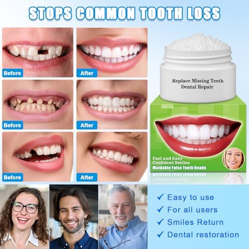Moldable False Teeth Beads - Temporary Tooth Repair Kit | Fix Broken, Chipped Teeth, Cavity Temporary Fillings, Missing Tooth Gaps & Loose Dentures Within Minutes at Home KBN