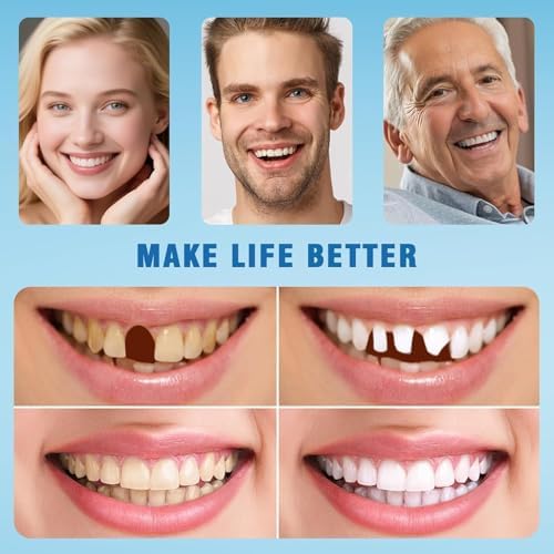 Moldable False Teeth - Silicone Dentures - Men and Veneers Teeth for Women - Upper and Lower Matching Set - Fix Your Smile at Within Minutes - Blue - 1PCS - S77