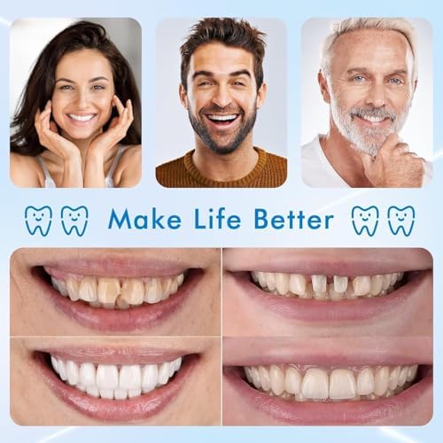 Moldable False Teeth - Silicone Dentures - Men and Veneers Teeth for Women - Upper and Lower Matching Set, Convenient and Quick, Suitable for Daily, Party - 1PCS - MU6