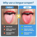 6 Pack Tongue Scrapers - Reusable & Easy to Clean Tongue Scrubber with Travel Case for Adults & Kids - Medical-Grade 100% Stainless Steel Tongue Cleaner for Fresh Breath & Oral Care