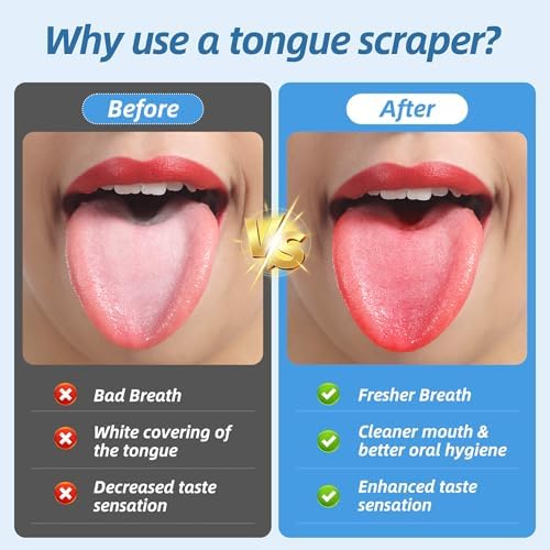 6 Pack Tongue Scrapers - Reusable & Easy to Clean Tongue Scrubber with Travel Case for Adults & Kids - Medical-Grade 100% Stainless Steel Tongue Cleaner for Fresh Breath & Oral Care