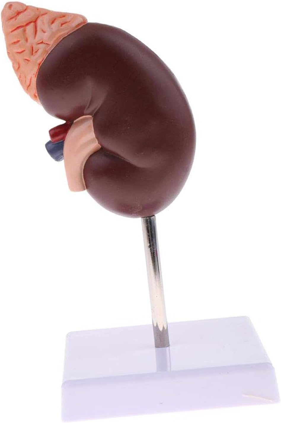 Human Kidney Model, Kidney Model Anatomy 24 Pointers for Learning
