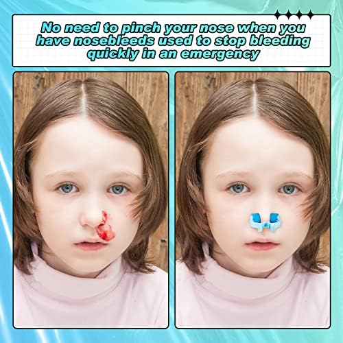 Fabbay 100 Pcs Stop Nosebleeds Clip Nose Bleed Stopper Nasal Clip for Adult Emergency Accident, Blue and Green