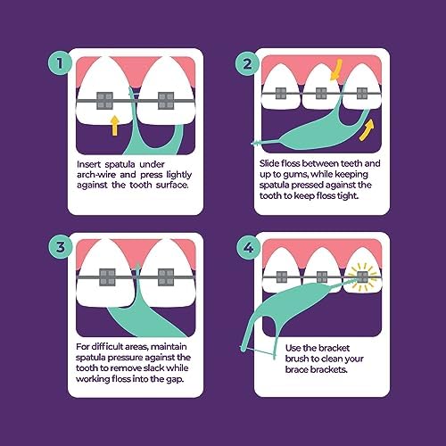 Platypus Orthodontic Flossers for Braces, 40 Count (Pack of 1), Ortho Picks for Adults & Kids, Fits Under Arch Wire, Non-Damaging, Encourage Flossing Habits