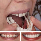 Veneer Teeth Kit -Natural Comfort Snap-on Dentures（2 packages4 Pieces ）