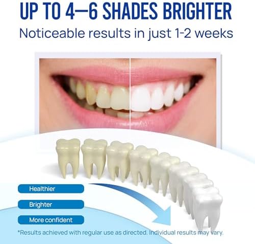 Teeth Whitening Pen Gel Kit: 35% Carbamide Peroxide Gel for Stain Removal - No Sensitivity with Remineralizing Pen for a Brighter Whiter Smile Mint (5 Pack)