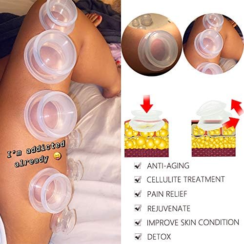 6 Sizes Cupping Therapy Set-Professional Cupping Therapy Studio and Household Silicone Cupping Set, Stronger Suction, Suitable for Myofascial Massage, Muscle, Nerve, Joint Pain