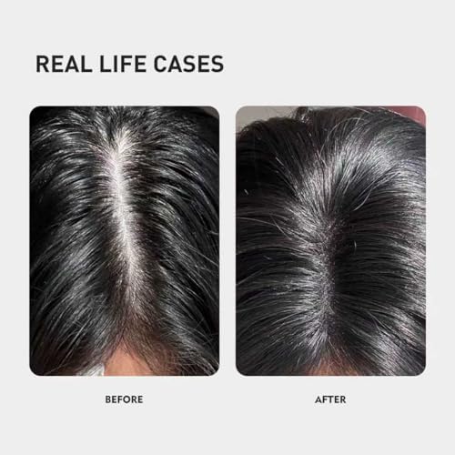 KINTOR 0.9% KX-826 DHT Blocker for Men & Women Hair Growth,Hair Growth Products Spray 60ml Pro