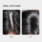 KINTOR 0.9% KX-826 DHT Blocker for Men & Women Hair Growth,Hair Growth Products Spray 60ml Pro