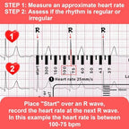 2PCS ECG Ruler, ECG 7 Step Ruler for ECG/EKG Interpretation, Transparent EKG Calipers Measuring Tool, Follow a 7 Step Plan, Portable ECG Assessment Tool EKG Card