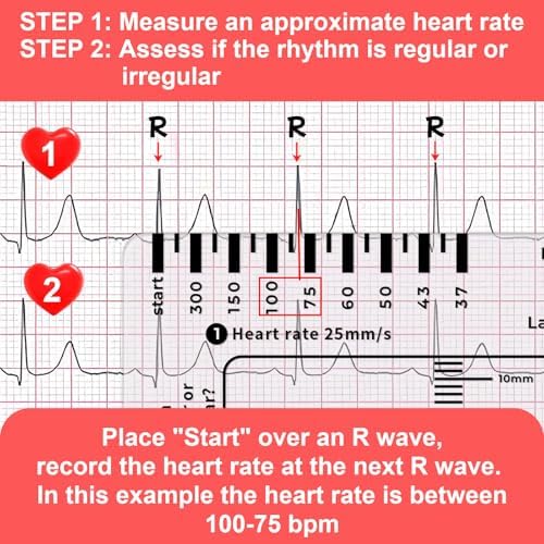 2PCS ECG Ruler, ECG 7 Step Ruler for ECG/EKG Interpretation, Transparent EKG Calipers Measuring Tool, Follow a 7 Step Plan, Portable ECG Assessment Tool EKG Card
