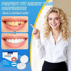 Adjustable Fake Teeth Veneers Kit – Instant Smile Covers for Broken or Missing Teeth, Natural Fit Cosmetic Dental Veneers, Upper & Lower Temporary Tooth Cover Set