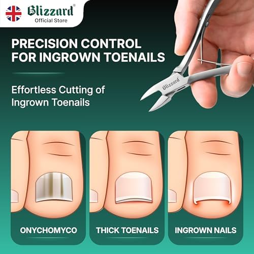 Ingrown Nail Clippers for Men with Ingrown Toenails – Blizzard Podiatrist Toenail Clipper Set German Forged (13cm - Straight Head - Smooth)