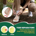 4Pcs Metatarsal Pads & Toe Separators for Women & Men - Ball of Foot Cushion, Gel Toe Spacers for Pain Relief, Metatarsalgia, Morton’s Neuroma, Long Hours of Standing or Walking
