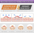 Silicone Scar Sheets,Silicone Scar Tape,Silicone Scar Removal Strips for Surgical,C-Section,Tummy Tuck,Keloid Scars (1.6"X 157" Roll-4M) Keloid Bump Removal