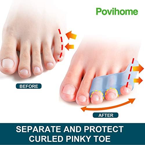 Povihome 10 Pack Pinky Toe Separator and Protectors for Overlapping Toe, Curled Pinky Toes - Spacers for Morton's Neuroma Pain Relief