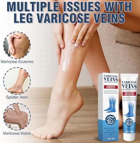 Varicose Veins for Legs, Varicose Veins Cream for Spider Veins, Solve Leg Heaviness and Swelling, Gentle Moisturizing, Improve Circulation 20 g(0.71 Ounce (Pack of 1))
