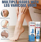 Varicose Veins for Legs, Varicose Veins Cream for Spider Veins, Solve Leg Heaviness and Swelling, Gentle Moisturizing, Improve Circulation 20 g(0.71 Ounce (Pack of 1))