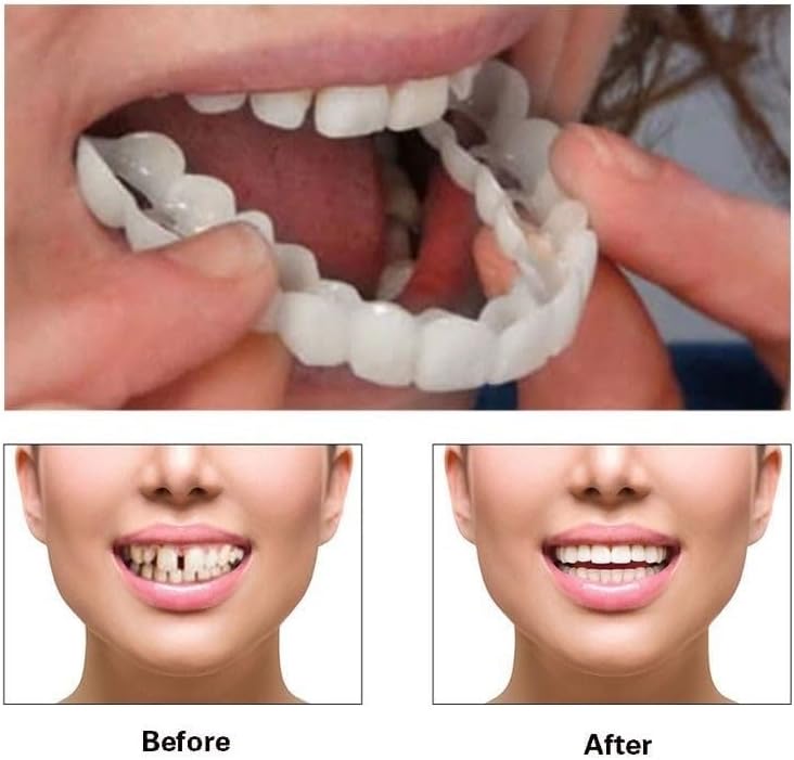 2 Pairs Temporary Smile Support Adjustable for All Genders - Natural Look & Comfort, Beautiful Smile Teeth Whitening Kits(White)