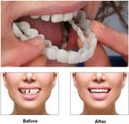 2 Pairs Temporary Smile Support Adjustable for All Genders - Natural Look & Comfort, Beautiful Smile Teeth Whitening Kits(White)