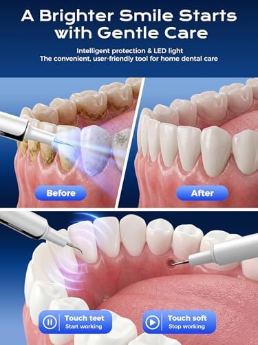 Plaque Remover for Teeth, 4-Mode Electric Tartar Remover with LED Light, Rechargeable Teeth Cleaning Kit, Dental Tools Set with 3 Replaceable Heads
