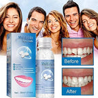 Tooth Repair Granules for Everyone,Temporary Tooth Repair Kit,Thermal Beads for Filling Fix The Missing and Broken Tooth,Restoring a Confident Smile (20ml)