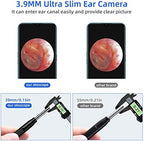 Jiusion 3.9mm Ultra-Thin Portable USB Digital Otoscope Camera with Carrying Case, HD 720P 6 LED Visual Ear Scope with 3 Hats 2 Silicone Caps 8 Earwax Spoons for Android Windows Mac NOT for iPhone iPad