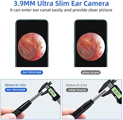 Jiusion 3.9mm Ultra-Thin Portable USB Digital Otoscope Camera with Carrying Case, HD 720P 6 LED Visual Ear Scope with 3 Hats 2 Silicone Caps 8 Earwax Spoons for Android Windows Mac NOT for iPhone iPad