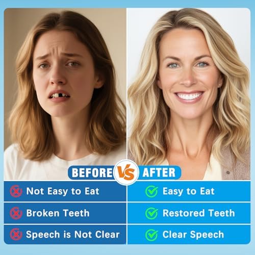 Moldable False Teeth - Silicone Dentures - Men and Veneers Teeth for Women - Upper and Lower Matching Set - Fix Your Smile at Within Minutes - Blue - 1PCS - Y7