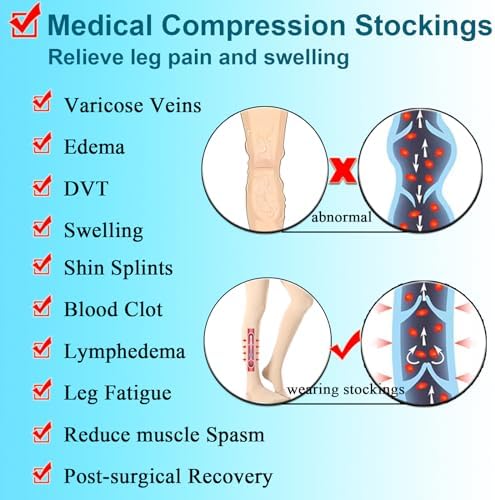 Thigh High Medical Compression Stockings for Women & Men,20-30 mmHg Thigh High Compression Socks,Open Toe Graduated Support Hose with Silicone Dot Band-Ideal for Varicose Veins,Edema,Swelling