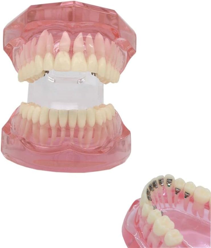 Orthodontic Metal/Ceramic/Invisible Brackets Lingual Brace Teeth Model (M3004: Invisible Metal Bracket Orthodontic Model)