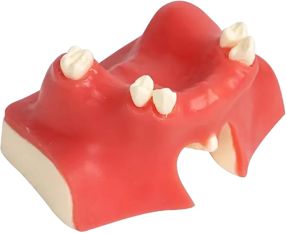 Dental Implant Training Model with Maxillary Sinus Lift Practice Realistic Simulation Jaw Cavity Lift Implant Placement Model