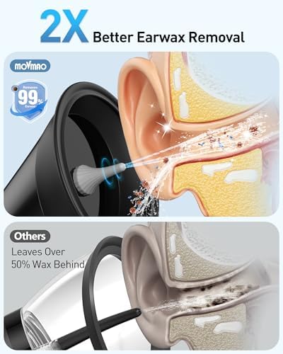 Ear Wax Removal, Electric Ear Cleaner with LED Display, FSA-HSA-Eligible, Ear Irrigation Kit with Dual Tank Includes 12 Tips, IPX7, Safe & Effective Cleaning for Adults & Kids, Easy to Use