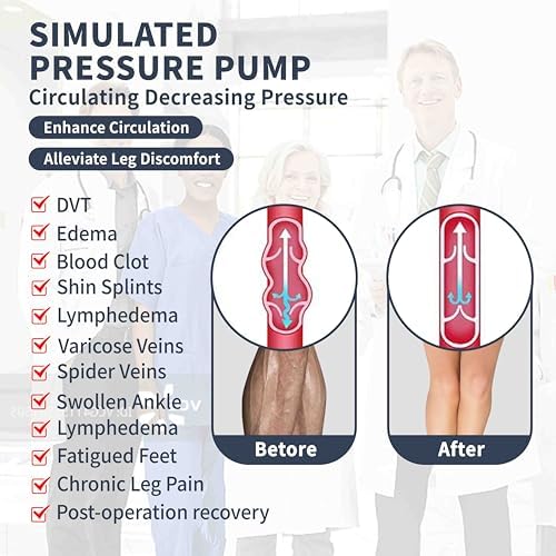 Medical Compression Thigh High Anti Embolism Stockings 15-20mmHg, for Edema, Varicose Veins, Swelling with Inspection Hole, Women & Men