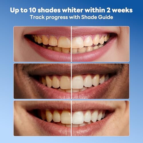 Teeth Whitening Pen Gel Kit: 22% & 35% Carbamide Peroxide Gel for Stain Removal - Enamel Safe with Soothing Gel Pen for Sensitive Teeth (5 Pack)