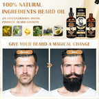 Beard Growth Oil for Men, 100% Natural Beard Oil with Argan Oil, Jojoba Oil, Castor Oil - 3.38 FL/100ML Fresh Fragrance Beard Conditioner Softens, Nourishes,Strengthens, Promotes Beard Growth