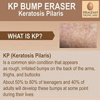HealFast KP Bump Eraser Bodywash – Soften, Exfoliate, Nourish Rough and Bumpy Skin with 3% BHA – Keratosis Pilaris - For All Types – No Scrubbing Required – Fragrance and Paraben Free
