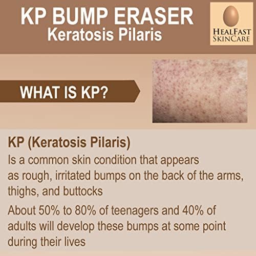 HealFast KP Bump Eraser Bodywash – Soften, Exfoliate, Nourish Rough and Bumpy Skin with 3% BHA – Keratosis Pilaris - For All Types – No Scrubbing Required – Fragrance and Paraben Free