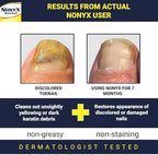 NONYX Fungal Nail Clarifying Gel | Clinically Proven for Discolored, Thick, Brittle, Yellow, Lifted, and other signs of Fungus-Damaged Toenails | 90% of Nails Improve | Over 8 million sold