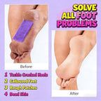 70 PCS Pedicure Exfoliator Kit Set 40 PCS Disposable Pedicure Pumice Stone for Foot Care Sponge Scrubber Callus Purple Coarse Dead Skin Remover 30 PCS Pedicure Nail Files (Pack of 70)