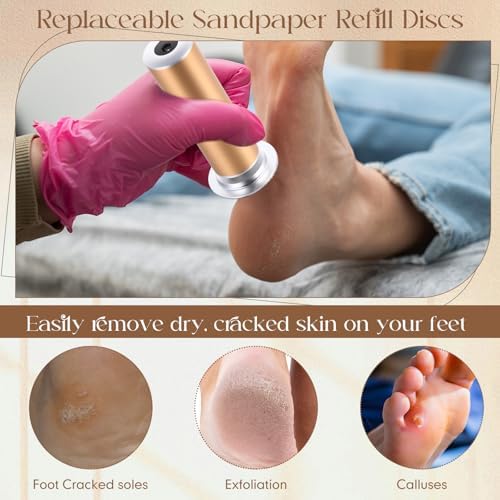 Gisafai 500 Pcs Sanding Replacement Pad Sandpaper Disk for Electric Foot File Callus Remover Tool Black Foot File Disc for Men Women Cracked Heels Dead Skin (100 Grit)