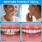 Veneers Teeth for Women, Tooth Replacement Missing Teeth, Upper Veneer Cosmetic, Moldable Thermal Beads Replacement Kit, Unisex to Temporary Tooth Repair Kit, 6PCS-EEr