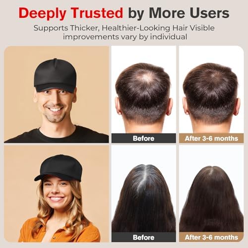 Red Light Therapy Hair Growth Cap, 540 LEDs Red Light Therapy for Hair Growth, Red Light Cap for Oily Scalp Reduction Improvement for Men & Women