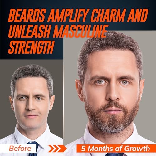 5% Minoxidil Beard Growth Serum for Men: 2-Pack Minoxidil Hair Regrowth Spray with Biotin & Rice Water - Extra Strength Beard Oil for Faster Thicker and Fuller Beard Growth - 4.06 Fl Oz