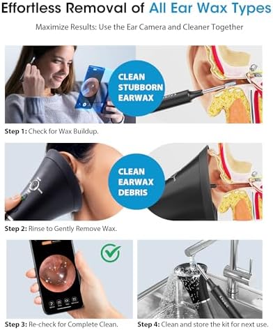 KAUGIC Ear Wax Removal Kit with Camera – Ear Cleaner Tool for Safe & Effective Ear Care – Includes Ear Camera for Visual Inspection & Gentle Ear Irrigation System – Complete Ear Cleaning Solution