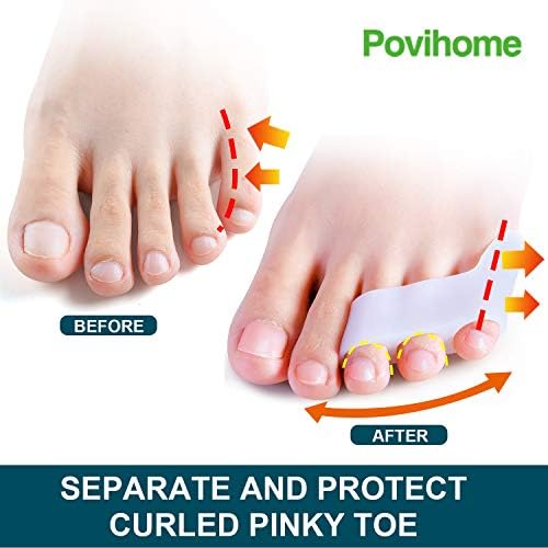 Povihome 10 Pack Pinky Toe Separator and Protectors, Triple Gel Toe Separators for Overlapping Toe, Curled Pinky Toes Separate and Protect