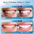 Teeth Whitening Kit with LED Light – 3 Whitening Gel Pens + 2 Desensitizing Pens – 35% Carbamide Peroxide – Whiten Teeth in 7 Days – Safe for Sensitive Teeth & Enamel, 0.7 Fl Oz (Mint)